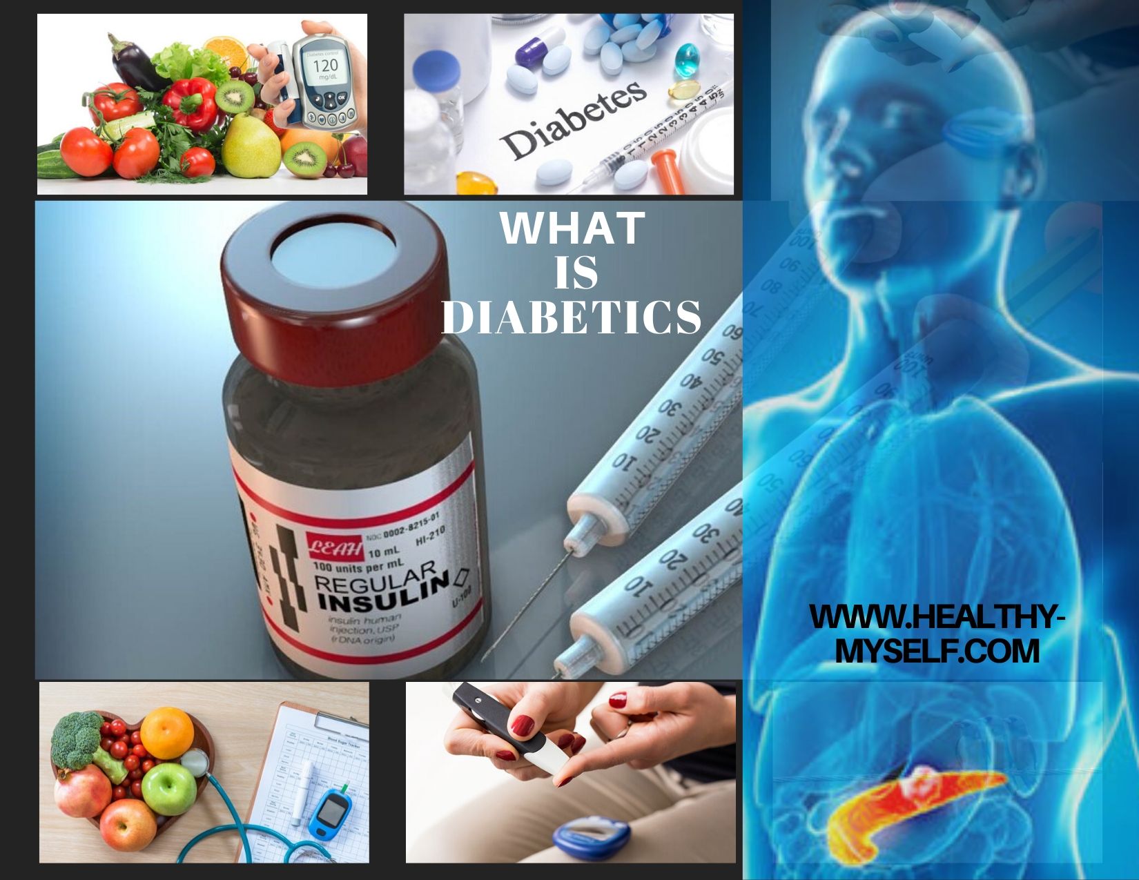 What Is Diabetics: Symptoms,Types,Causes And Prevention-2021
